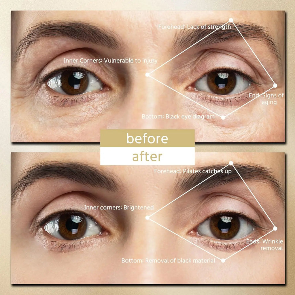 EyeLift Patch Pro™ Hands-Free EMS Eye Massager