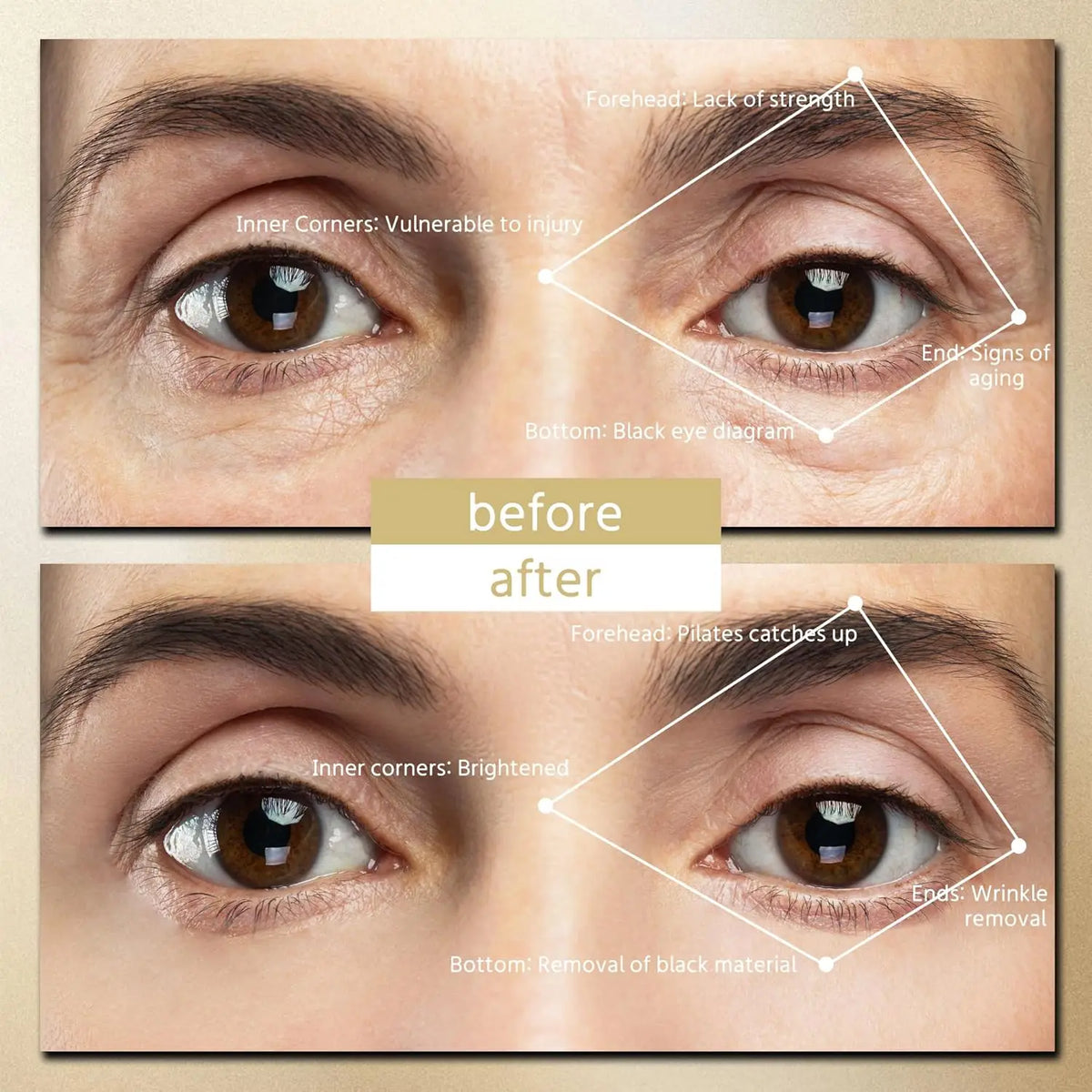 EyeLift Patch Pro™ Hands-Free EMS Eye Massager