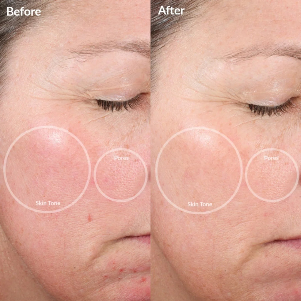 VeloSculpt Pro™ Electric EMS & RF Gua Sha Beauty Device