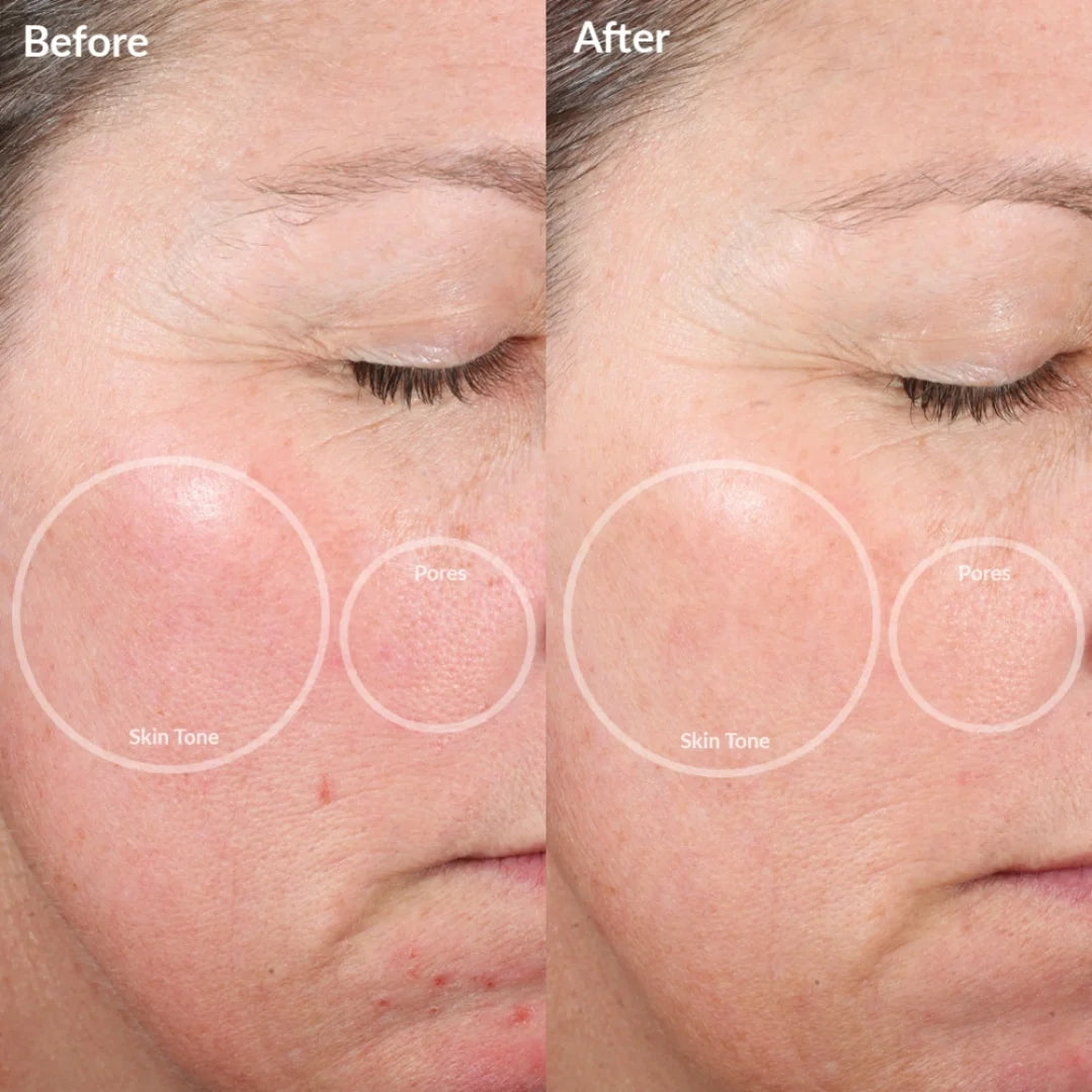 VeloSculpt Pro™ Electric EMS & RF Gua Sha Beauty Device
